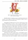 Imagine document Boala Crohn - Metode de Tratament