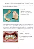 Imagine document Studiu privind aportul tehnicii dentare în tratarea fracturilor de mandibulă