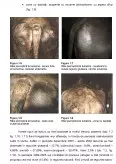 Imagine document Râia psoroptică la bubaline. Cercetări etiopatogenetice, imunologice și epidemiologice