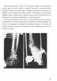 Imagine document Rolul ortopediei în tratamentul fracturilor radiusului distal