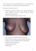 Imagine document Studiu privind cancerul mamar și factorii de risc