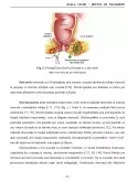 Boala Crohn - Metode de tratament