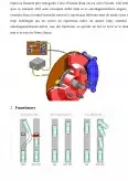 Imagine document Sistemul de frânare