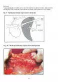 Imagine document Insuficiență hepatică - etiopatogeneza și complicații