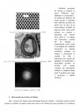 Imagine document Metode de analiza microscopică - microscopie electronică