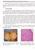 Imagine document Aspectele Histopatologice și Imunohistochimice ale Carcinoamelor Mamare, în Situ și Invazive