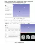 Imagine document Evidențierea tumorilor cu ajutorul 3D Slicer