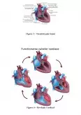 Imagine document Îngrijirea pacientului cu Insuficiență Cardiacă Globală